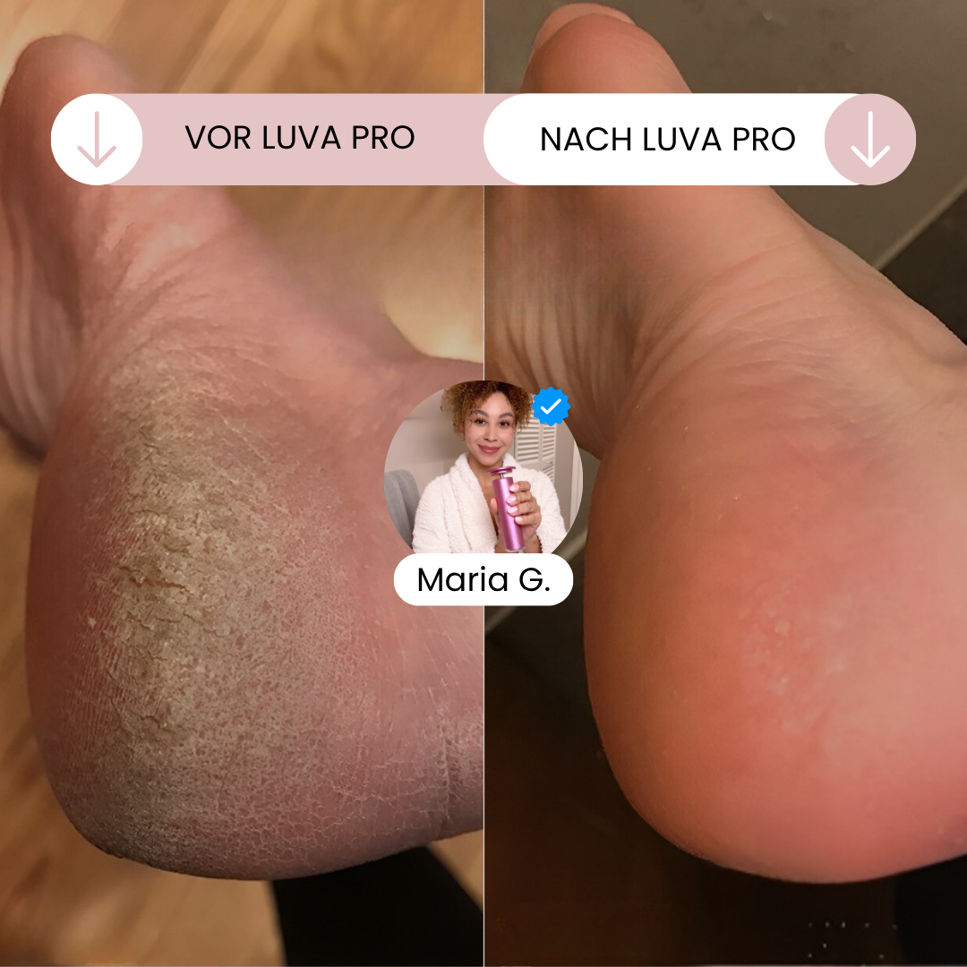 Luva Pro